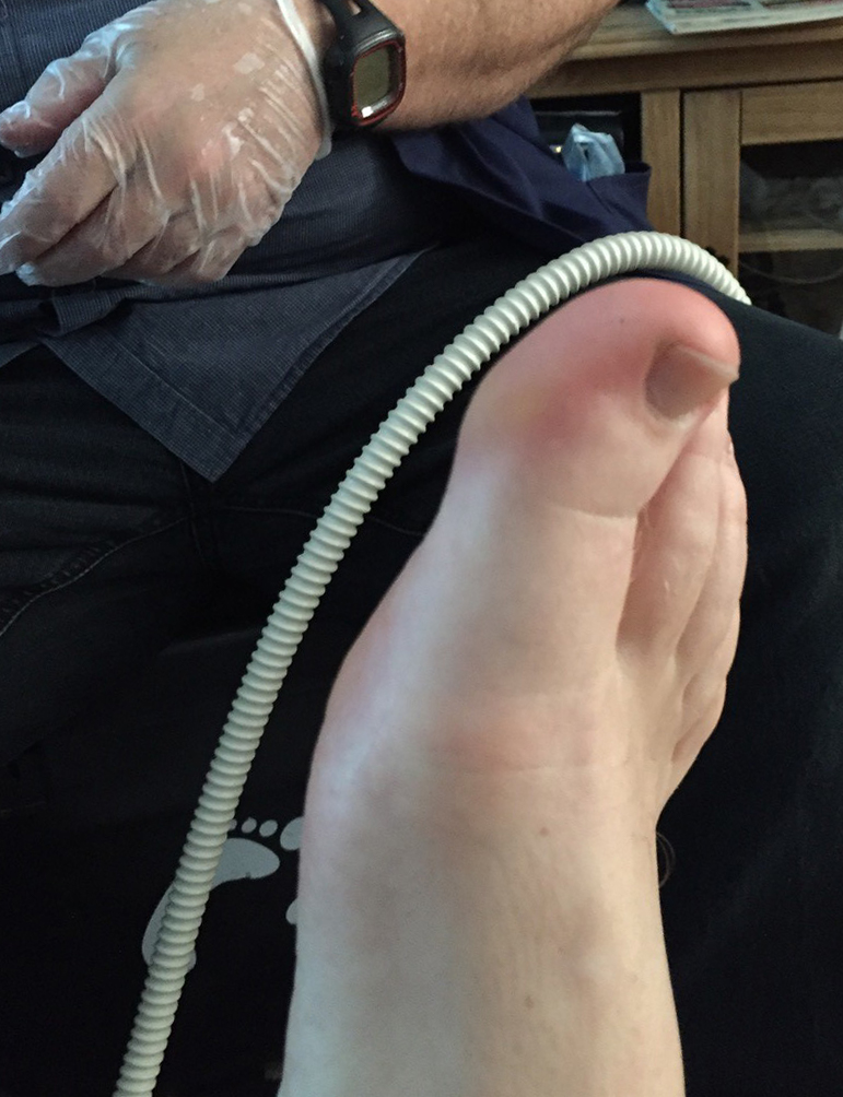 The finished foot close up
