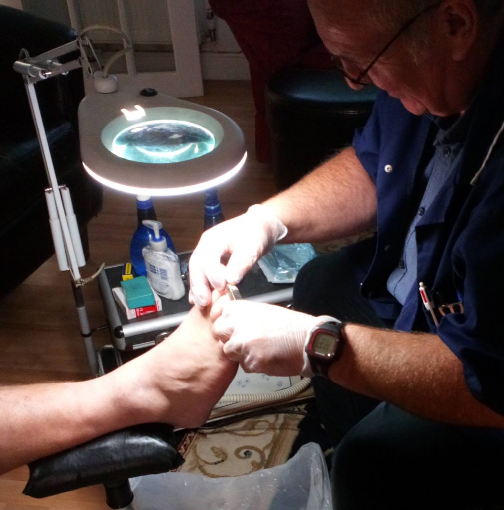 Filing the trimmed nails