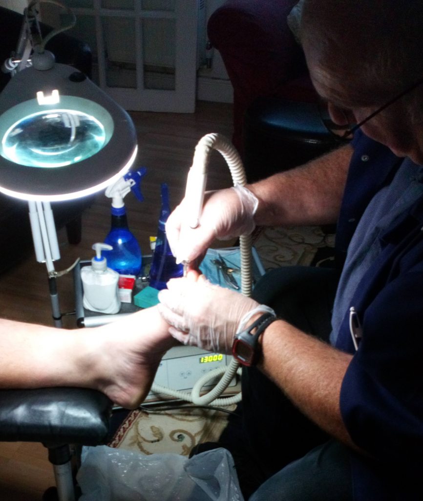 Thick nail treatment